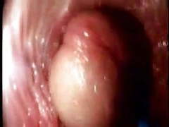 KiloLesbians presents: Video from the inside of a vagina... very interesting